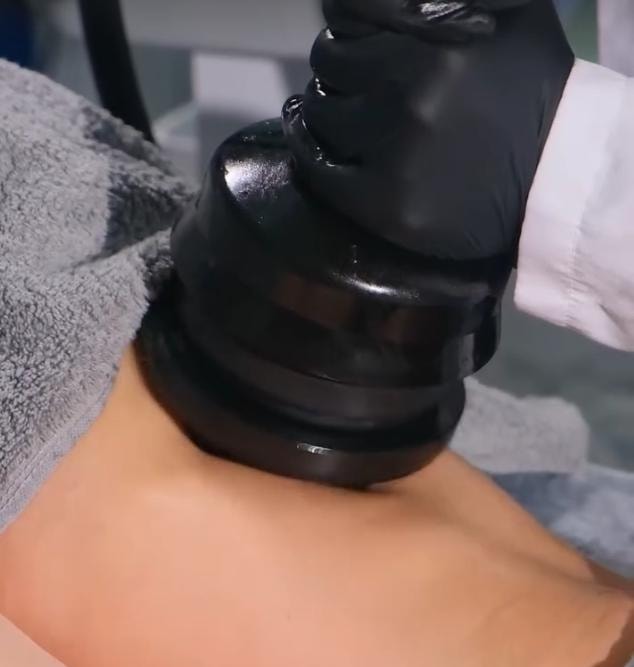 Bölgesel İncelme uygulama 3